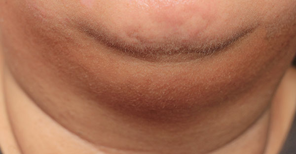 double chin double chin