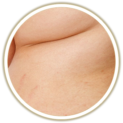 fat bubble
