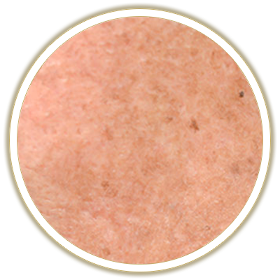 sun bubble