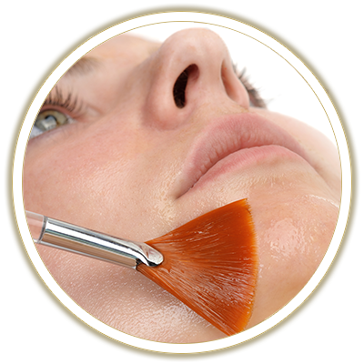 chemical peels bubble