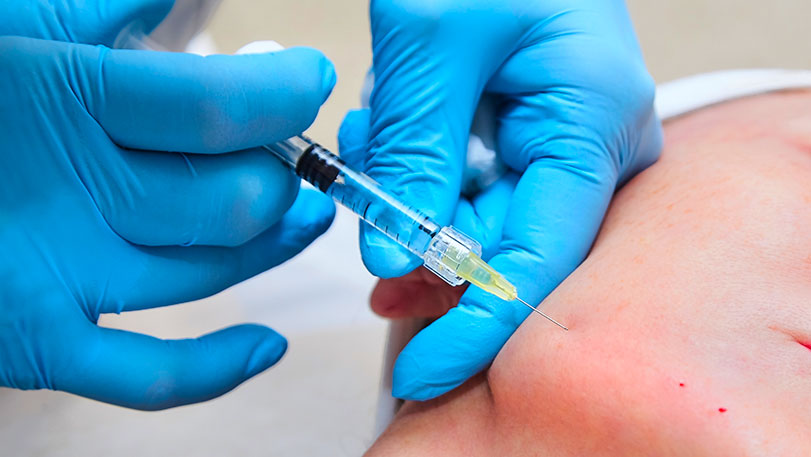kybella