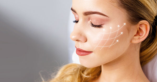 cheek volume loss