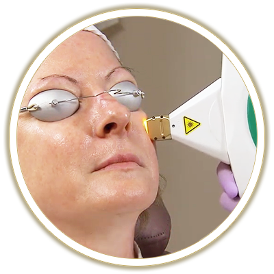 ipl photo facial bubble