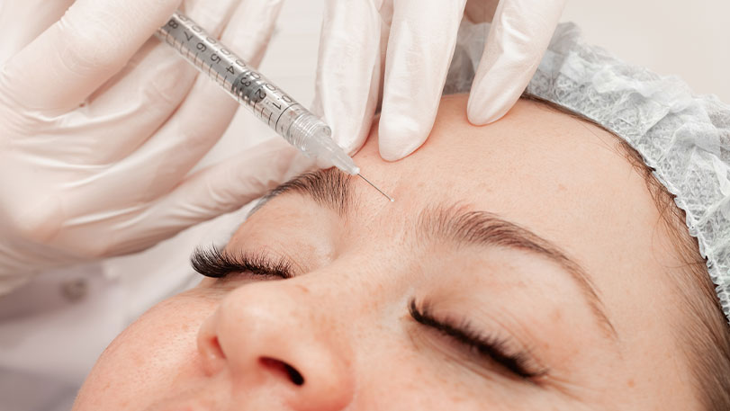 juvederm ultra fillers