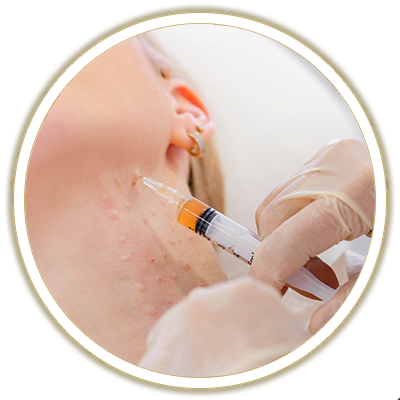 prp facelift bubble