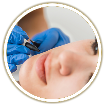 skin growth removal bubble