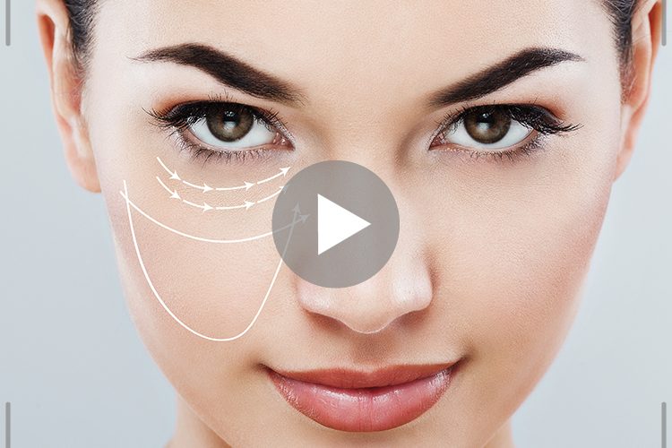 under eye bags
