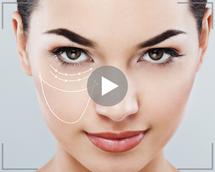 under eye bags