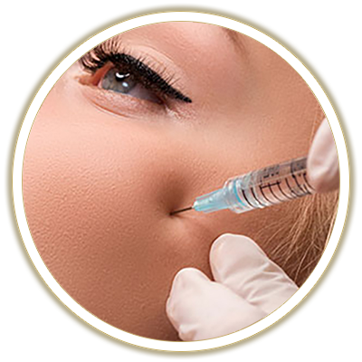 radiesse filler treatment