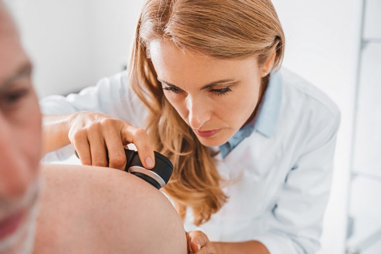 different types of skin cancer san ramon