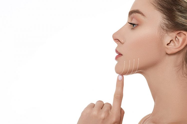 how to correct Jowls san ramon