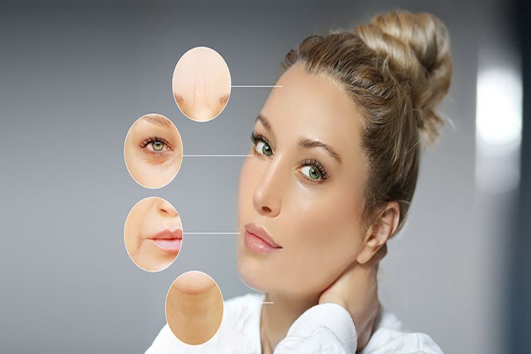 how to get rid of nasolabial lines san ramon