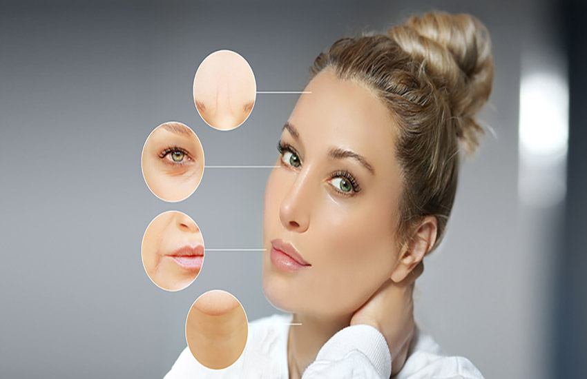how to get rid of nasolabial lines san ramon