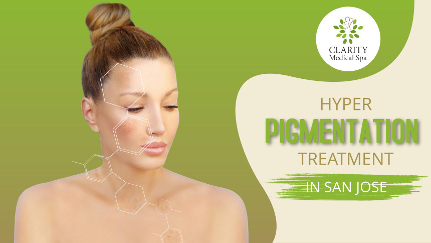 hyperpigmentation treatment in san jose