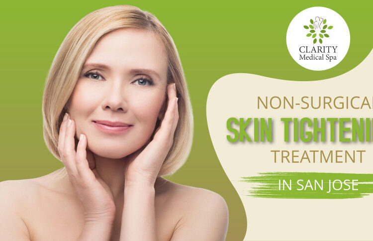 nonsurgical skin tightening treatment in san jose