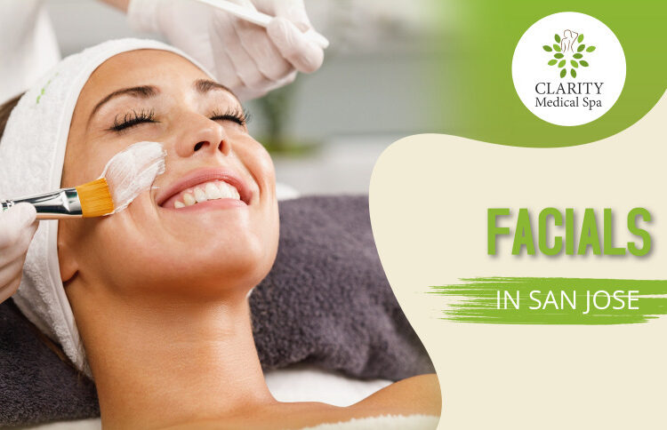 facials in san jose 1