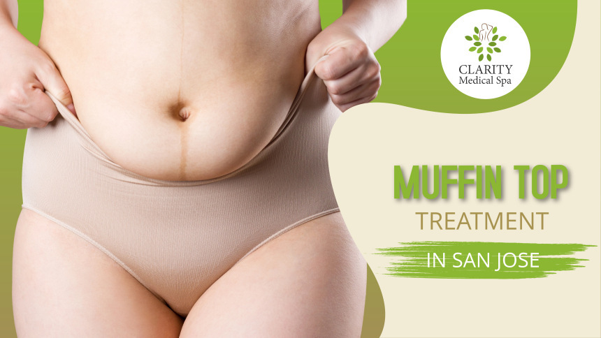 muffin top treatment in san jose