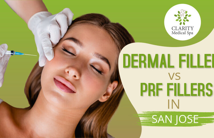 dermal fillers vs prf filler in san jose