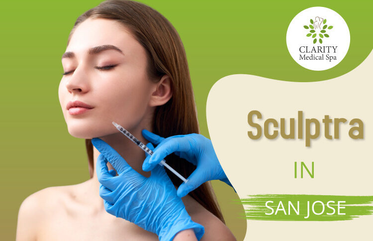 sculptra in sanjose