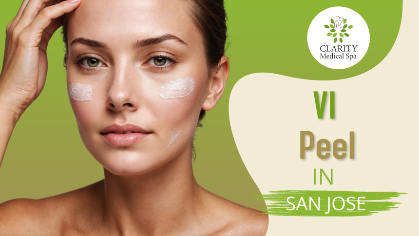 vi peel in sanjose